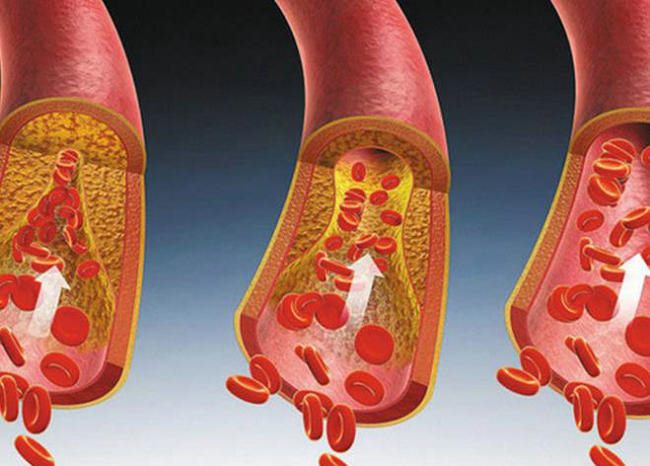 20210625163124_21630 20210625163124_21630