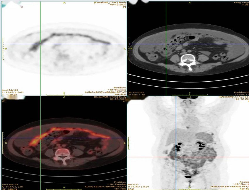 640.webp (6) 640.webp (6)