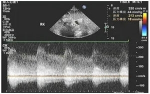 640.webp (1) 640.webp (1)
