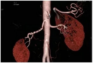 640.webp (5) 640.webp (5)