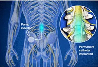 640 (1)_副本 640 (1)_副本