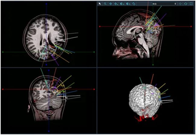 640 (2)_副本 640 (2)_副本