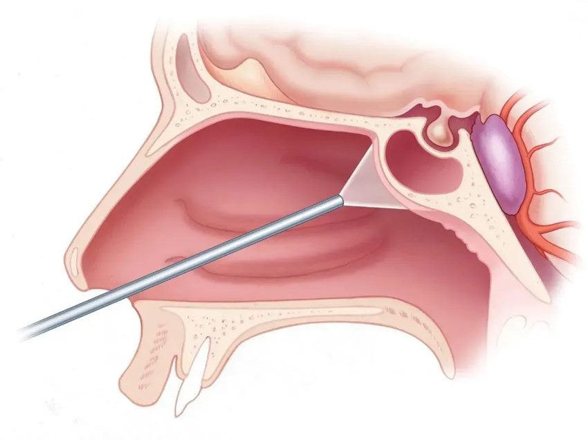 640_副本 640_副本