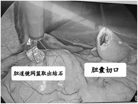 640 (3)_副本 640 (3)_副本