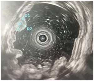 640 (3)_副本 640 (3)_副本