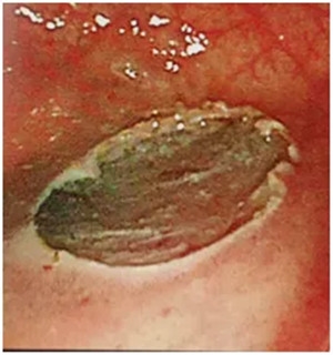 640 (4)_副本 640 (4)_副本