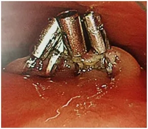 640 (5)_副本 640 (5)_副本