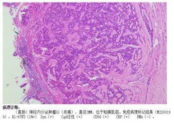 640 (6)_副本 640 (6)_副本