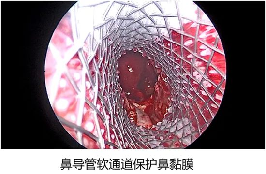 640 (1)_副本 640 (1)_副本