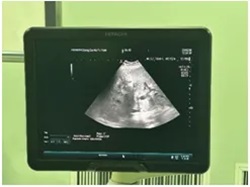 640 (4)_副本 640 (4)_副本