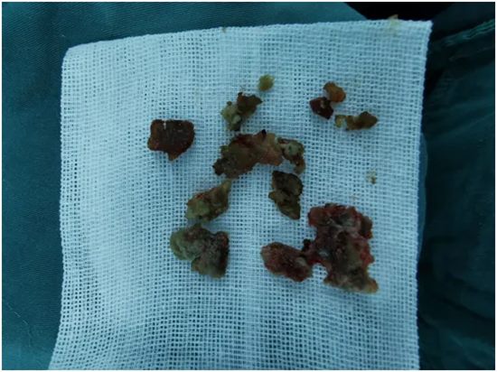 640_副本 640_副本