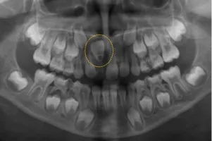 640 (1)_副本 640 (1)_副本